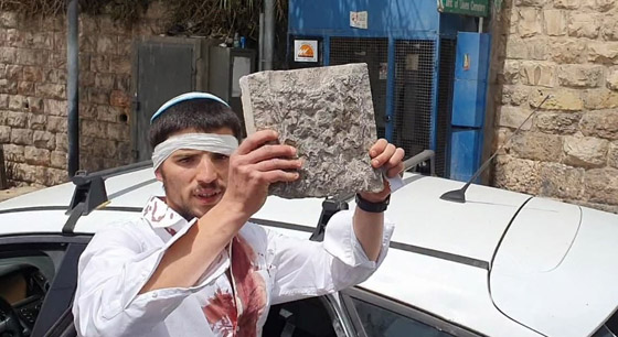 فيديوهات صادمة: بعد اقتحام شرطة إسرائيل للمسجد الأقصى، مستوطن يدهس مصلين ويقول: هم رجموني بالحجارة صورة رقم 1