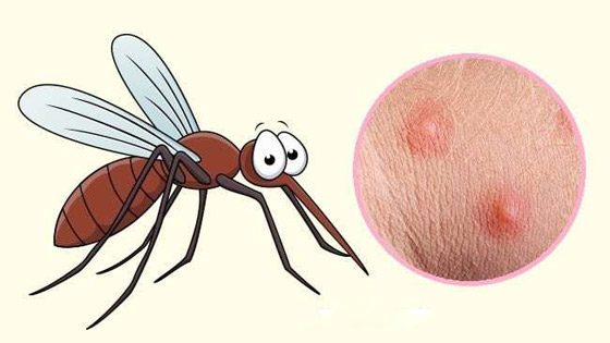 البعوض.. وأشهر الحشرات اللادغة وأعراض الإصابة صورة رقم 4