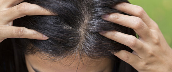 هل يسبب التوتر تحول لون الشعر إلى الرمادي؟ صورة رقم 4