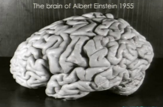 هل دماغه مختلف فعلا؟ قصة سرقة دماغ أينشتاين واللعنة التي أصابت سارقه صورة رقم 1
