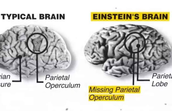 هل دماغه مختلف فعلا؟ قصة سرقة دماغ أينشتاين واللعنة التي أصابت سارقه صورة رقم 10