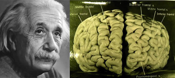 هل دماغه مختلف فعلا؟ قصة سرقة دماغ أينشتاين واللعنة التي أصابت سارقه صورة رقم 3