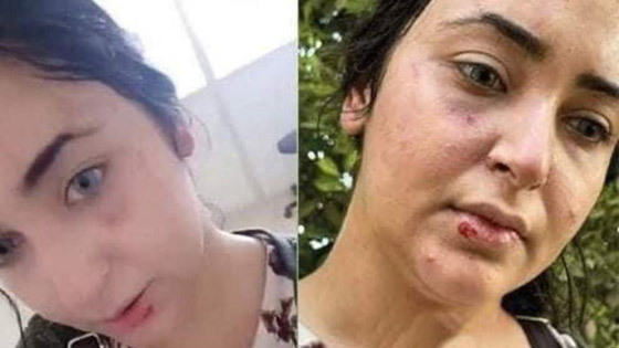 فيديو أثار الغضب الشديد: ضرب وسحل دكتورة صيدلانية مصرية لعدم لبسها الحجاب! صورة رقم 3