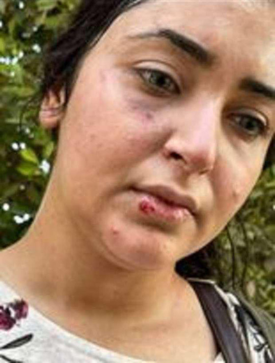 فيديو أثار الغضب الشديد: ضرب وسحل دكتورة صيدلانية مصرية لعدم لبسها الحجاب! صورة رقم 5