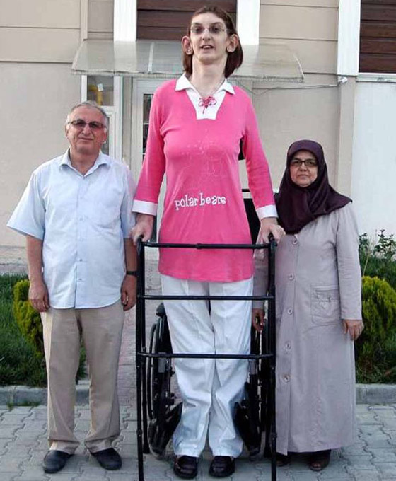 تركية تدخل موسوعة غينيس كأطول امرأة في العالم، ورسالتها: تقبلوا أنفسكم! صورة رقم 8