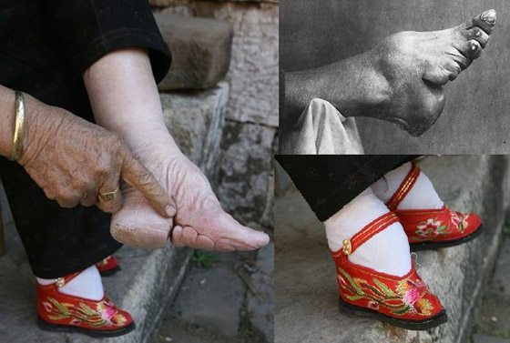 منها أحذية تكسر العظام.. إليكم أغرب صيحات الجمال التي هددت حياة البشر صورة رقم 5