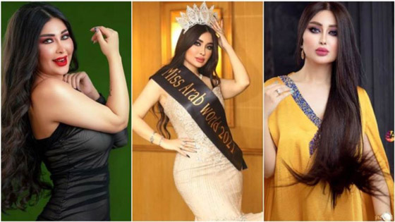 فيديو وصور: هجوم وتنمر على ملكة جمال العرب العراقية مارينا العبيدي بسبب شكلها قبل التجميل!  صورة رقم 1