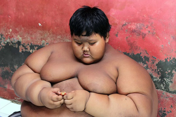 أثقل طفل في العالم يخسر 120 كيلوغراماً من وزنه صورة رقم 5