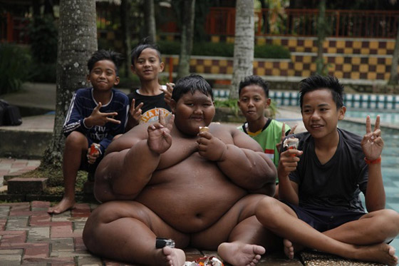 أثقل طفل في العالم يخسر 120 كيلوغراماً من وزنه صورة رقم 7