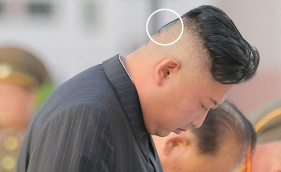 كدمة داكنة وضمادة.. رأس زعيم كوريا الشمالية كيم يثير الحيرة والمخاوف! صورة رقم 3