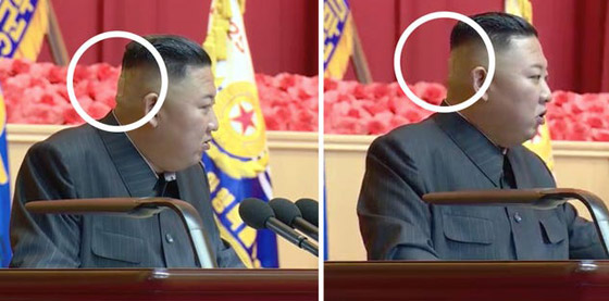 كدمة داكنة وضمادة.. رأس زعيم كوريا الشمالية كيم يثير الحيرة والمخاوف! صورة رقم 5