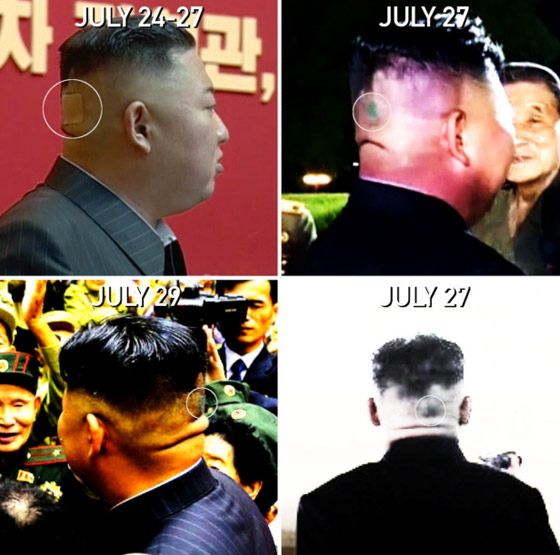 كدمة داكنة وضمادة.. رأس زعيم كوريا الشمالية كيم يثير الحيرة والمخاوف! صورة رقم 7