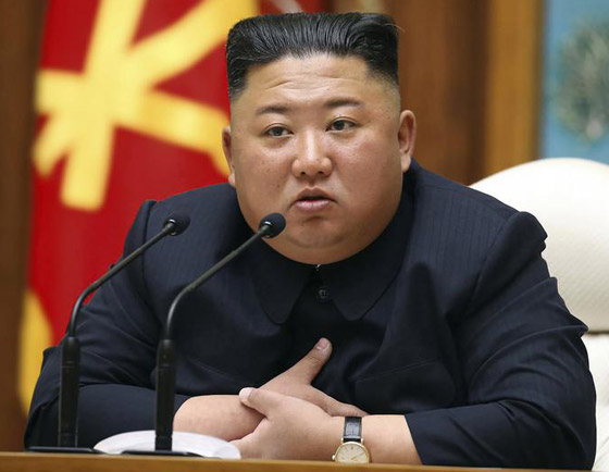 كدمة داكنة وضمادة.. رأس زعيم كوريا الشمالية كيم يثير الحيرة والمخاوف! صورة رقم 10