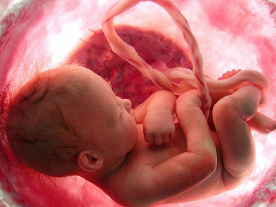  صورة رقم 1 - ماذا يعني الإجهاض في الحلم؟
