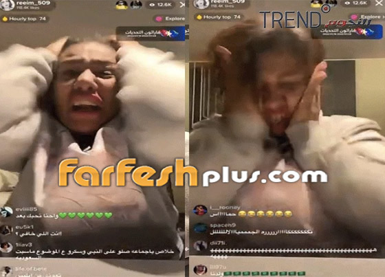  صورة رقم 3 - فيديو صادم: مشهورة كويتية تفقد أعصابها بجنون وتضرب نفسها وتشد شعرها ببث مباشر!
