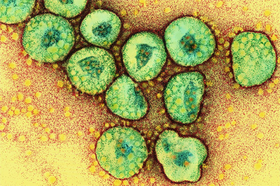  صورة رقم 4 - هل نحن على موعد مع وباء جديد؟.. العلماء يتخوفون من 3 فيروسات!