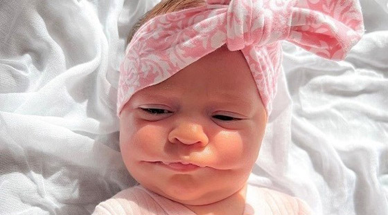 طفلة تولد بابتسامة دائمة بسبب حالة نادرة صورة رقم 1