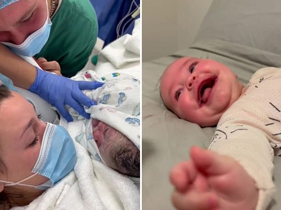 طفلة تولد بابتسامة دائمة بسبب حالة نادرة صورة رقم 2