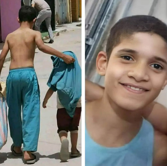  صورة رقم 1 - صورة تخطف القلوب.. طفل جزائري خلع قميصه ليحمي شقيقه من الشمس