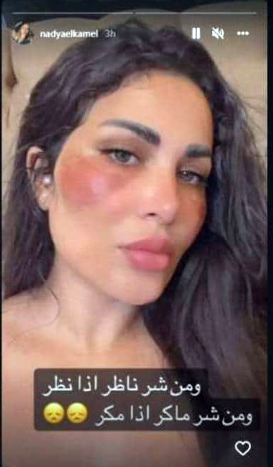  صورة رقم 4 - هجوم على ندى الكامل طليقة أحمد الفيشاوي لتحريف آية قرآنية وتزعم حرق وجهها!