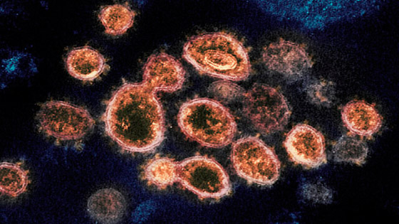  صورة رقم 2 - فيروس لانغا: فيروس حيواني جديد يُصيب عشرات الأشخاص في الصين