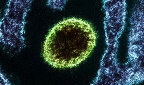  صورة رقم 5 - فيروس لانغا: فيروس حيواني جديد يُصيب عشرات الأشخاص في الصين