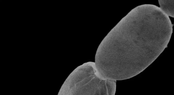  صورة رقم 6 - بالصور.. شاهد أكبر بكتيريا بالعالم ترى بالعين المجردة