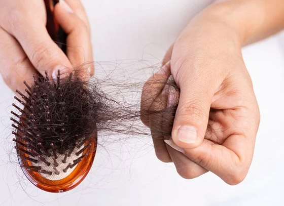 معتقدات وسخافات شائعة حول تساقط الشعر.. ما هي الحقيقة؟ صورة رقم 2