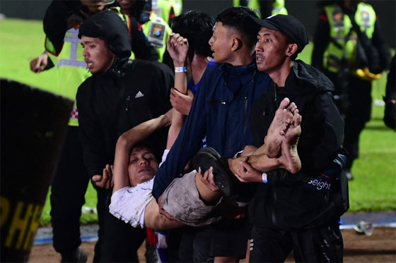  صورة رقم 17 - فيديو: 174 قتيلا و180 جريحا بأعمال شغب عقب مباراة كرة قدم بإندونيسيا