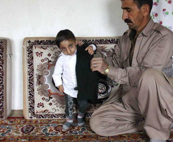  صورة رقم 11 - طوله 64.7 سنتيمتر.. شاب إيراني يستعد للقب أقصر رجل في العالم