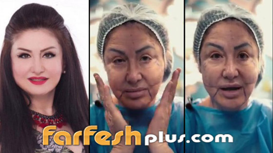 وفاء سالم تفجر مفاجآت عن عمليات التجميل في وجهها (فيديو) صورة رقم 1