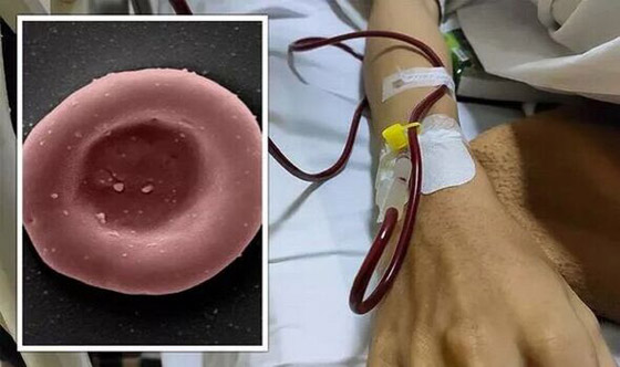 صورة رقم 1 - لأول مرة في التاريخ.. حقن خلايا دم أُنتجت مخبريا بجسم شخص