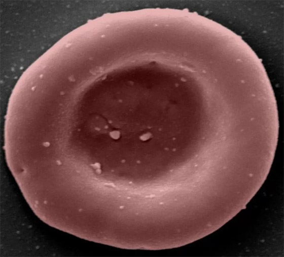  صورة رقم 8 - لأول مرة في التاريخ.. حقن خلايا دم أُنتجت مخبريا بجسم شخص
