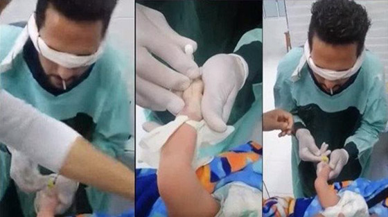  صورة رقم 1 - فيديو مؤلم: ممرض معصوب العينين يراهن زميله ويركب كانيولا لرضيع يصرخ ألما!