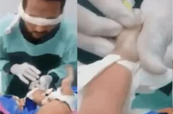  صورة رقم 3 - فيديو مؤلم: ممرض معصوب العينين يراهن زميله ويركب كانيولا لرضيع يصرخ ألما!