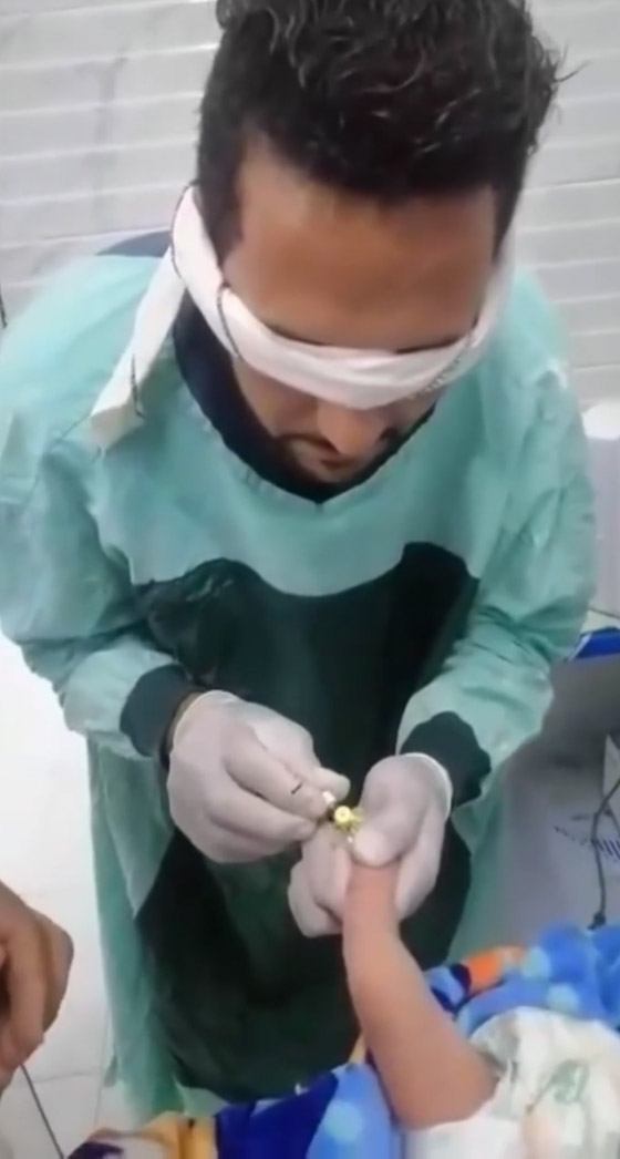 صورة رقم 5 - فيديو مؤلم: ممرض معصوب العينين يراهن زميله ويركب كانيولا لرضيع يصرخ ألما!
