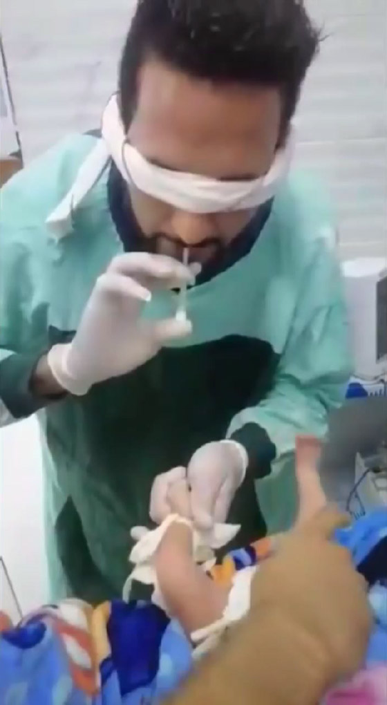  صورة رقم 7 - فيديو مؤلم: ممرض معصوب العينين يراهن زميله ويركب كانيولا لرضيع يصرخ ألما!