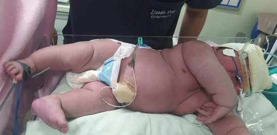  صورة رقم 4 - أضخم مولود في العالم! امرأة برازيلية تُنجب طفلا بوزن 