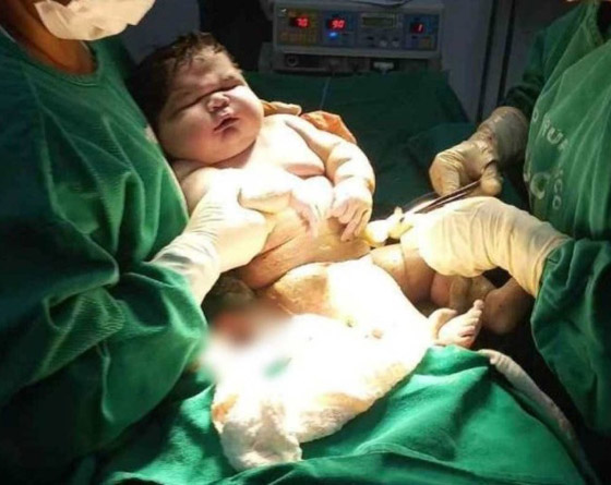  صورة رقم 5 - أضخم مولود في العالم! امرأة برازيلية تُنجب طفلا بوزن 