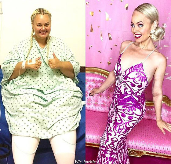 امرأة سمينة تخسر 90 كغم من وزنها بسبب سفرة بالطائرة وتتحول الى 