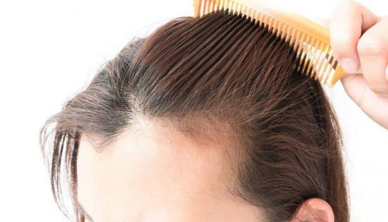  صورة رقم 1 - لعلاج تساقط الشعر.. إليك 7 طرق طبيعية فعالة