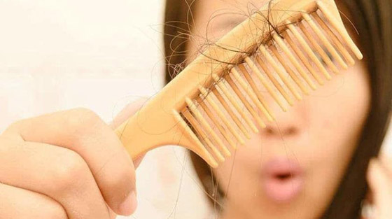 صورة رقم 2 - لعلاج تساقط الشعر.. إليك 7 طرق طبيعية فعالة