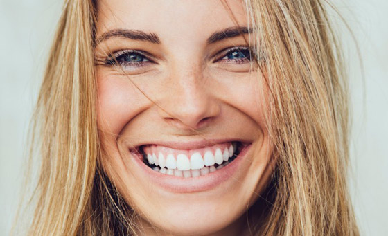  صورة رقم 3 - إليكم 5 طرق مدهشة لابتسامة هوليوودية دون تبييض الأسنان