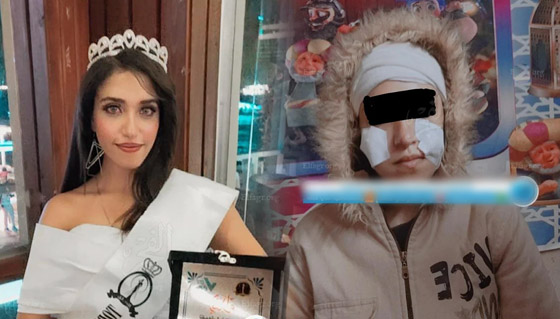فيديو وصور مؤسفة: شاب يشوه وجه جارته ملكة الجمال المصرية بـ25 غرزة! صورة رقم 1