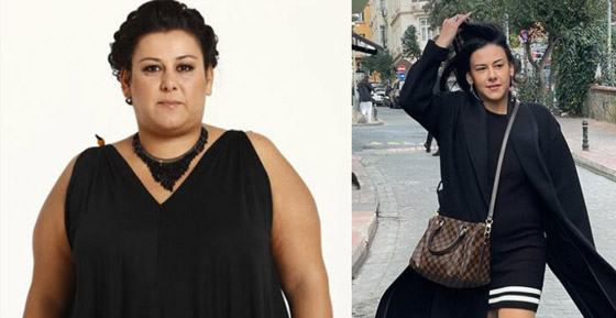  صورة رقم 4 - صور: نجمة تركية محرجة بعد أن كذبها طبيبها وفضحها! ادعت خسارة وزنها طبيعيا