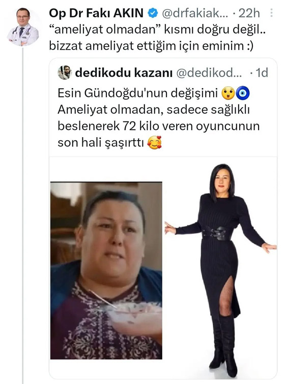  صورة رقم 2 - صور: نجمة تركية محرجة بعد أن كذبها طبيبها وفضحها! ادعت خسارة وزنها طبيعيا