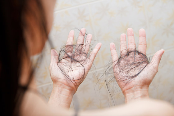  صورة رقم 2 - تعرفوا إلى 10 أسباب هي الأكثر شيوعا لتساقط الشعر غير الطبيعي