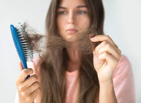  صورة رقم 1 - تعرفوا إلى 10 أسباب هي الأكثر شيوعا لتساقط الشعر غير الطبيعي