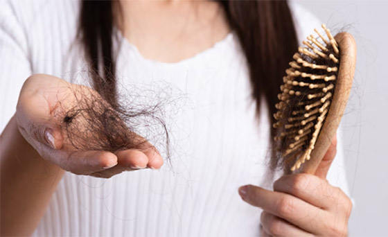  صورة رقم 6 - تعرفوا إلى 10 أسباب هي الأكثر شيوعا لتساقط الشعر غير الطبيعي