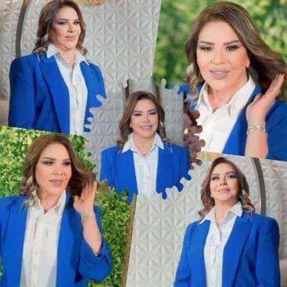  صورة رقم 1 - ‏صور سلمى المصري تكشف تشوه وجها بعد عمليات التجميل الكثيرة!!